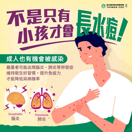 不是只有小孩才會長水痘
